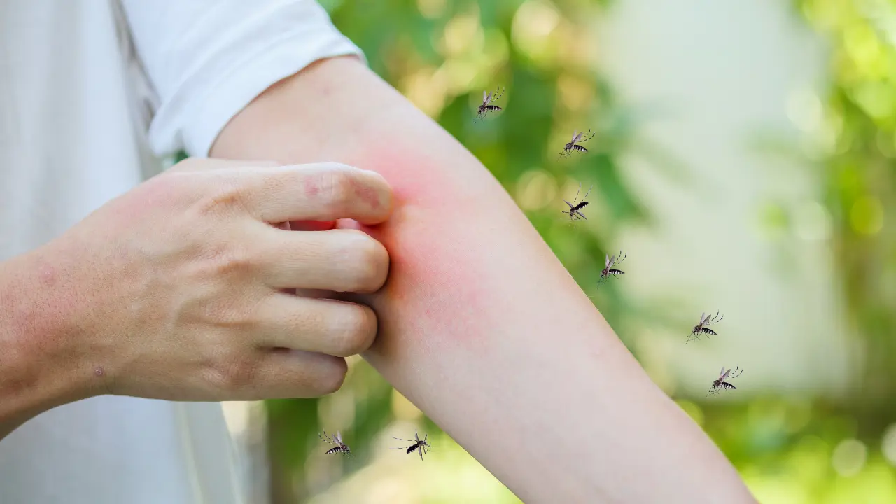 Dont Ignore Those Mosquito Bites! How to Spot, Treat, and Prevent Them man itching and scratching on arm from allergy skin rash cause by mosquito bites