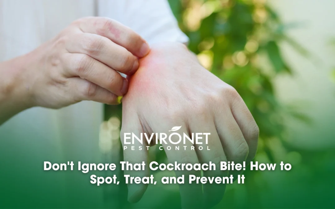 Don’t Ignore That Cockroach Bite! How to Spot, Treat, and Prevent It