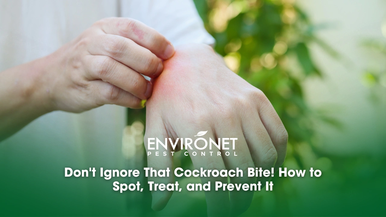 Don't Ignore That Cockroach Bite! How to Spot, Treat, and Prevent It man itching and scratching on hand from allergy skin reaction or from kagat ng ipis